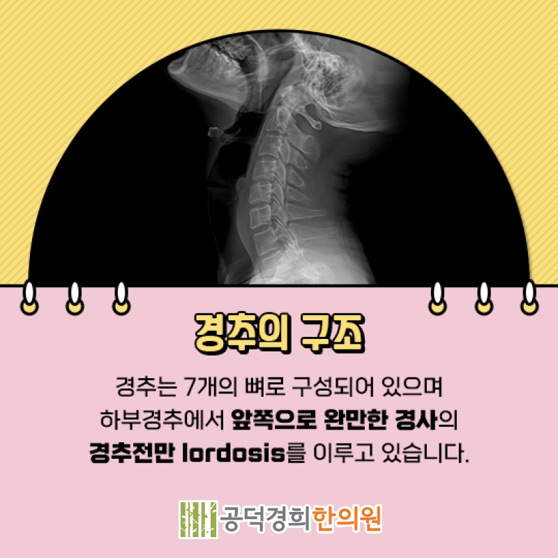 목이 앞으로 굽는 거북목증후군, 주요 신호 점검하기