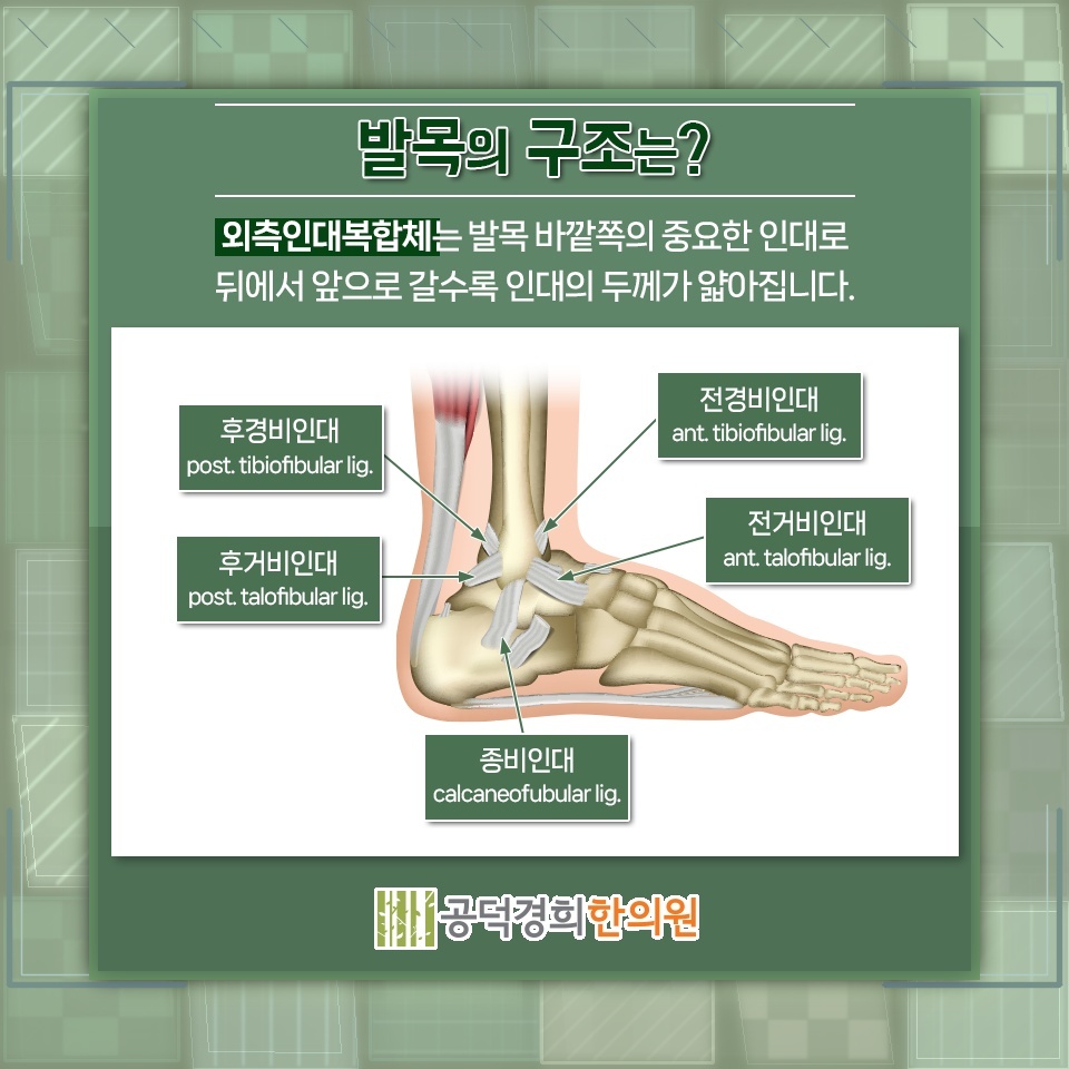 발목을 접질린 뒤 나타나는 염좌 증상과 회복 과정