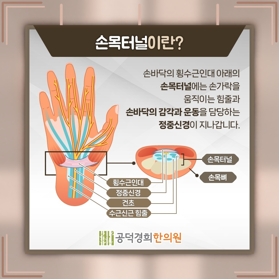 손끝 저림까지 이어지는 손목터널증후군의 주요 신호