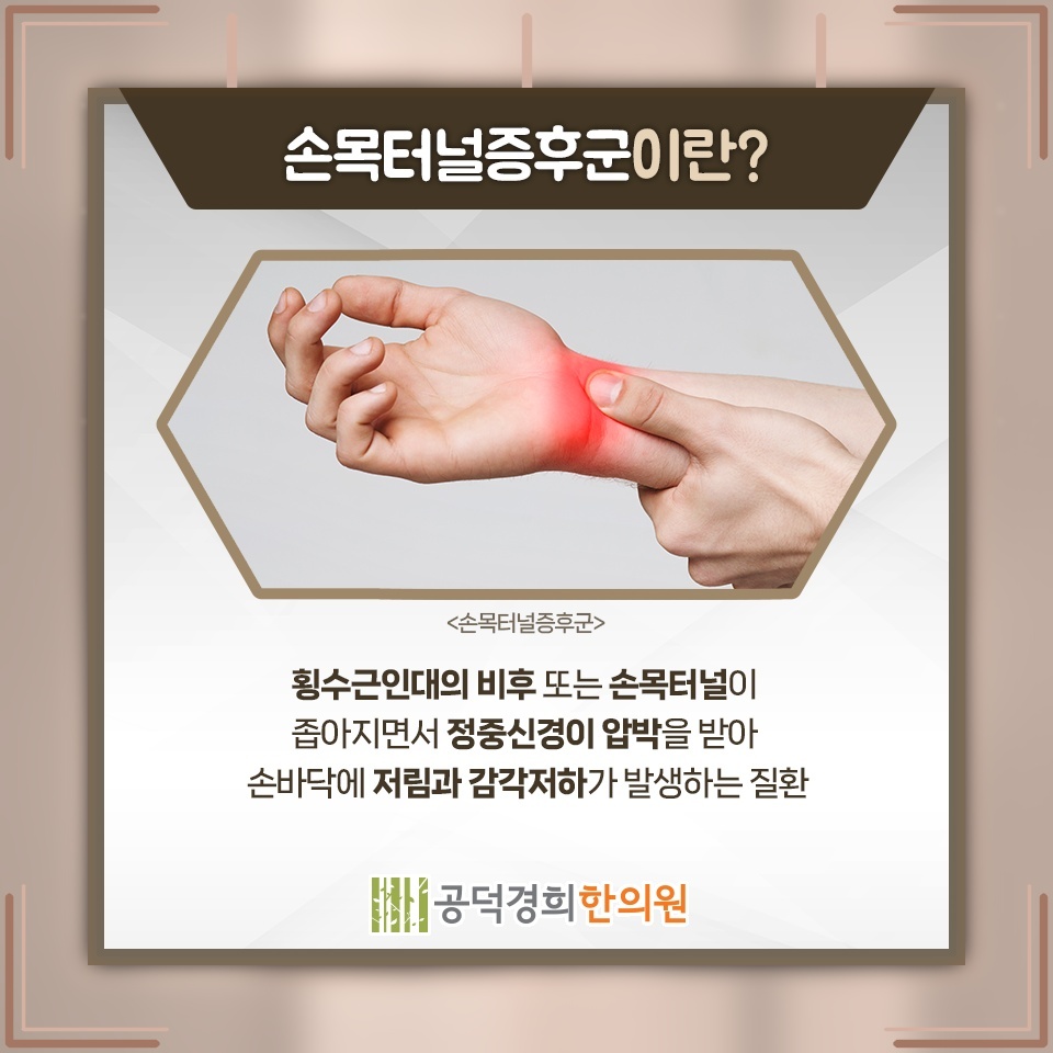 손끝 저림까지 이어지는 손목터널증후군의 주요 신호